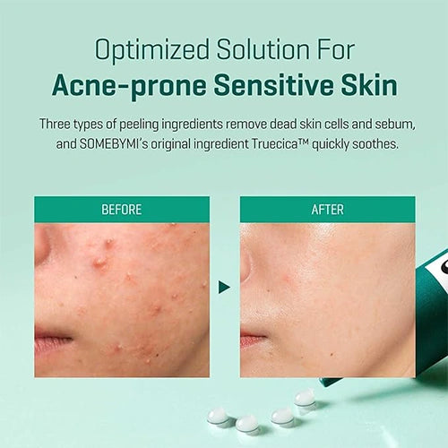SOME BY MI – AHA-BHA-PHA Miracle Cream For Acne